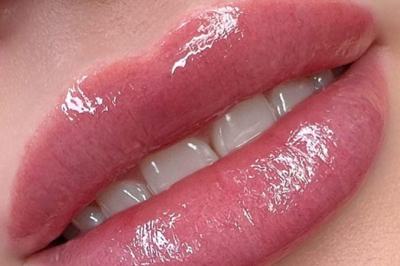 הדגשת שפתיים לאחר טיפול ראשון